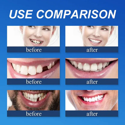 🌎Ends Today: 70% OFF! ⏰ Medical Full Denture with Strong Suctiond